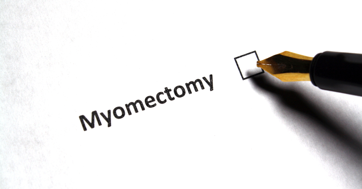 A hysterectomy is still the only definitive treatment option for removing fibroids permanently. A myomectomy is a uterine-sparing treatment.