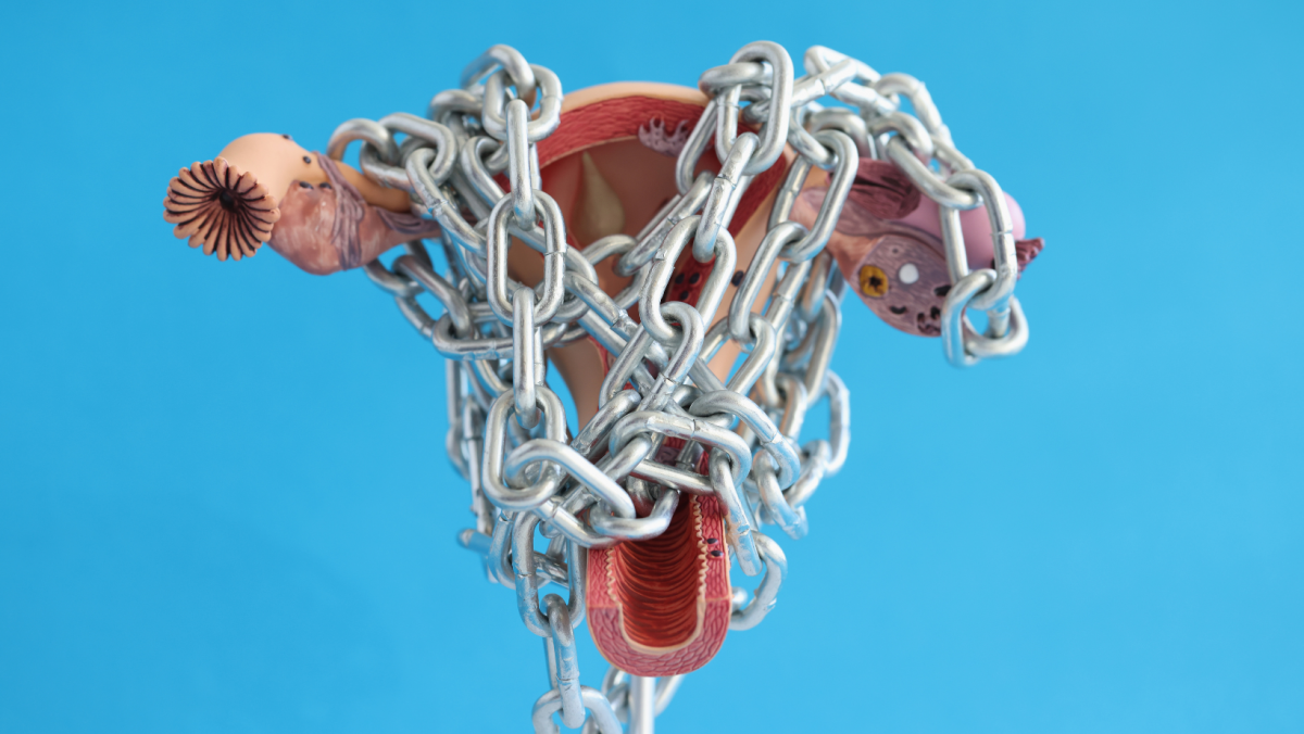 Does fibroid location matter?