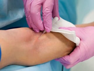 patient’s leg receiving injection for PAD or peripheral artery disease